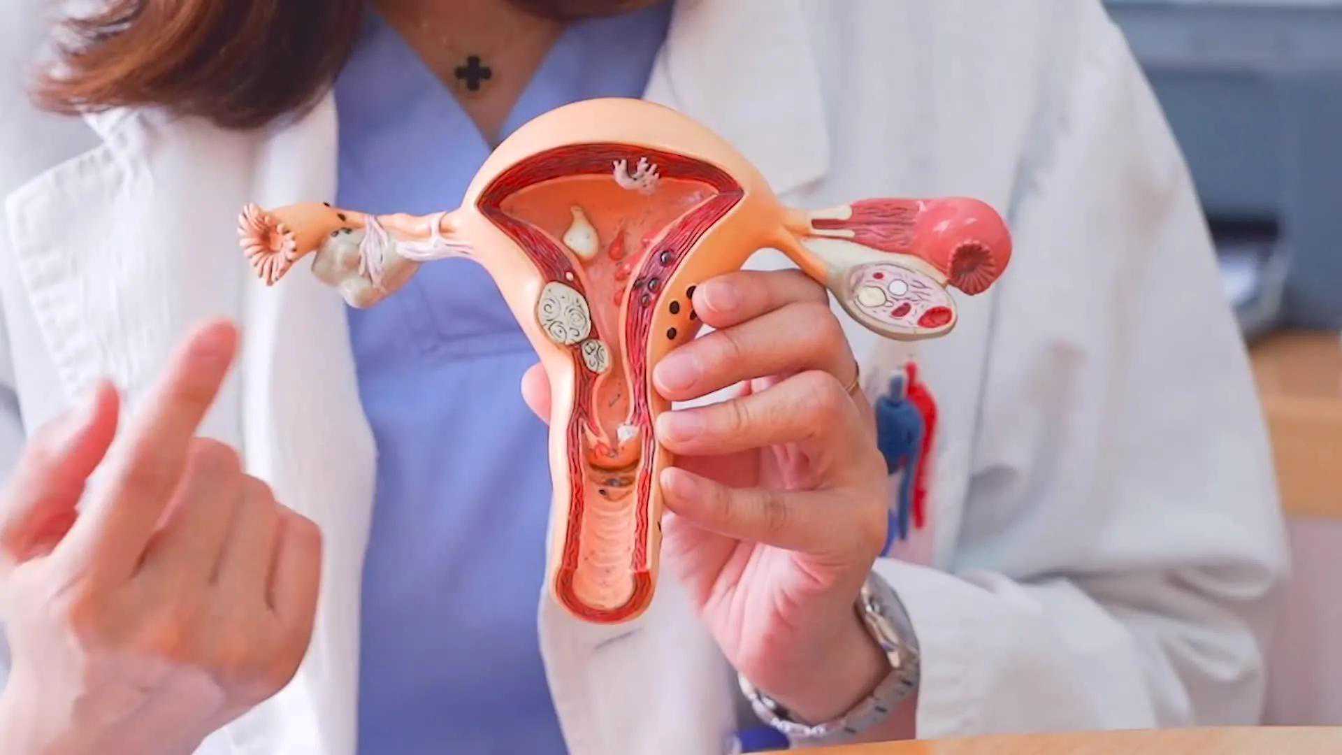 二婚与丈夫结婚后好不容易怀孕，结果是宫外孕。