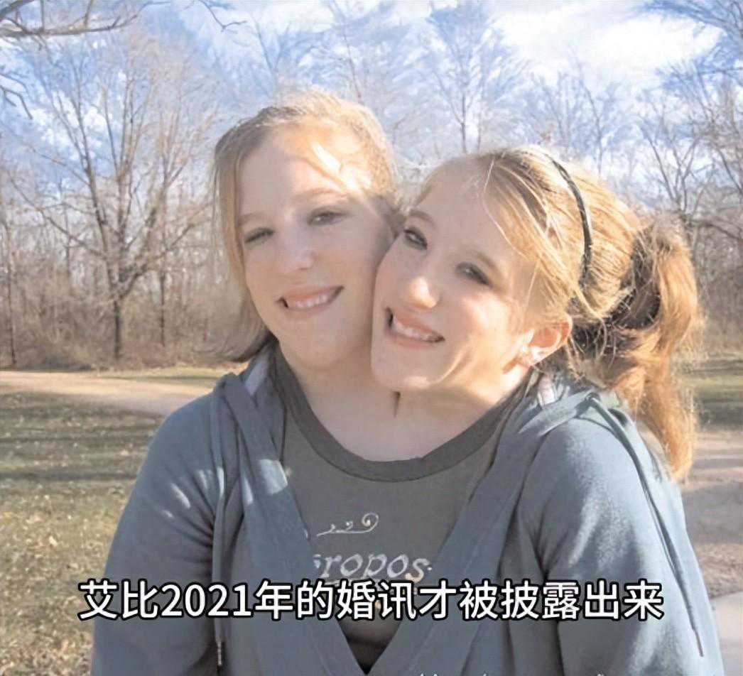 爱在特殊的双生：连体姐妹艾比与布列塔尼的奇迹婚姻