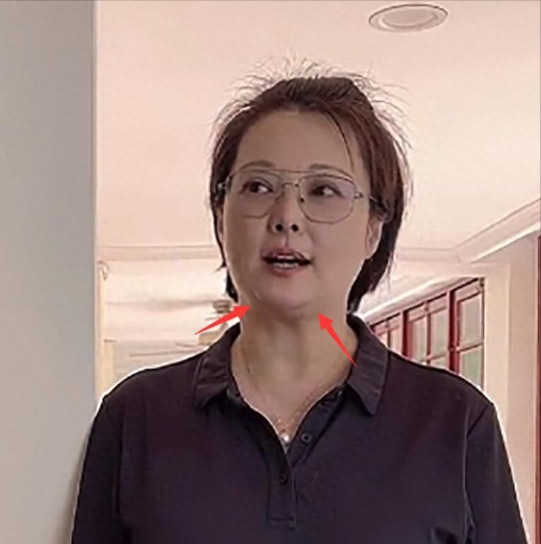 51岁袁立罕见露面，体重疑飙至150斤，腿上疤痕，可见婚姻状况