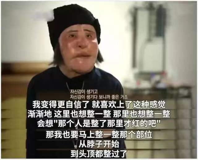 整容狂人乔斯林：嫁豪门失败，离婚分得25亿美元，如今怎么样了？