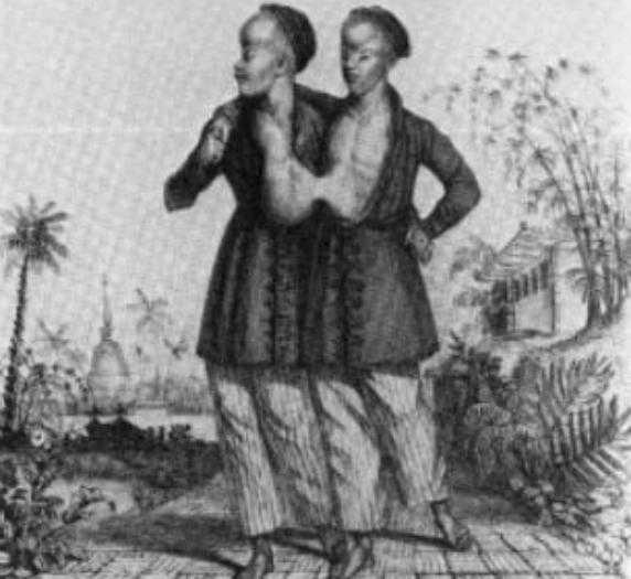 连体人怎样结婚生子？“暹罗双胞胎”娶白人姐妹花，生育22个孩子