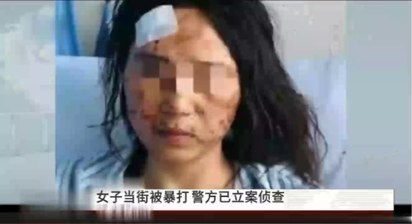 女子婚内出轨被暴打，公公抓烂她的脸，女子弟弟：还往她嘴里塞污秽物