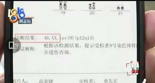 傻眼！一份婚检报告差点让夫妻变姐妹，男方几乎没有睡过一个安稳觉